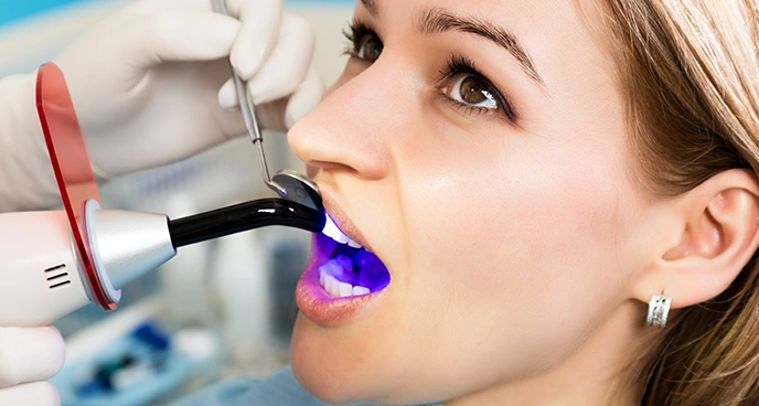 Advantages of dental Bonding – Bayswater dental clinic