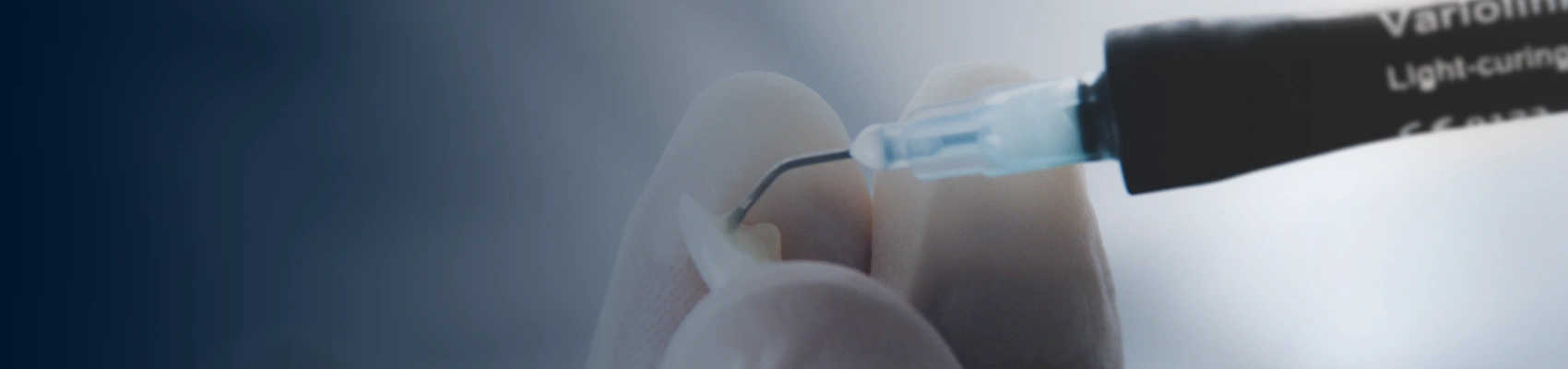 Dental  Veneers Banner Image – Bayswater Dental Clinic