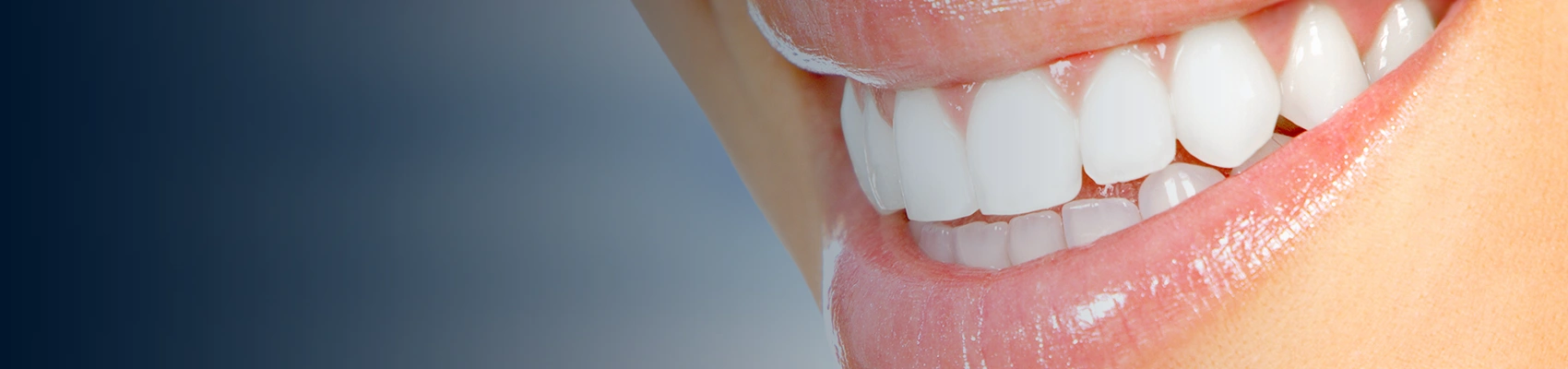 Benefits of Laser Gum Contouring Banner Image 