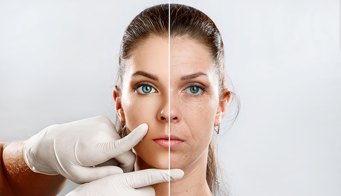 Cheek Bone Augmentation – Suitable candidate