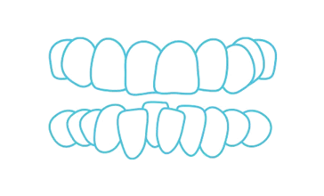Crowding icon - Bayswater Dental Clinic