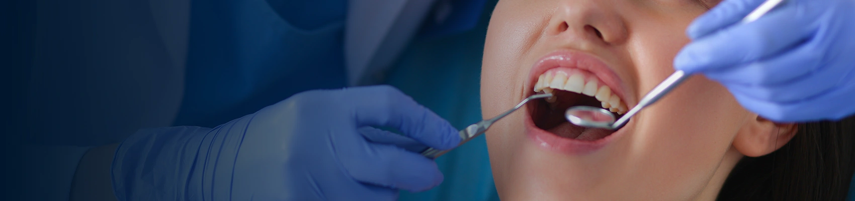 Deep Bite Tooth Contouring Banner Image at Bayswater Dental Clinic