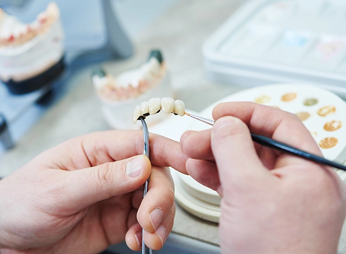 Dental Bridges provider in London – Bayswater Dental Clinic