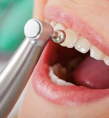 Dental Hygienist in London – Bayswater Dental Clinic