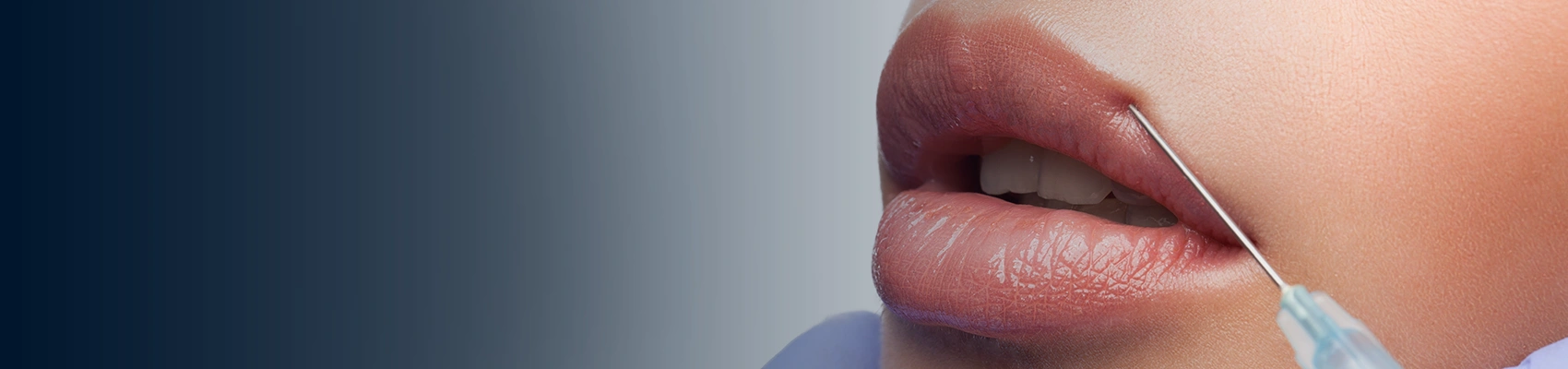 Are Dermal Fillers Safe?