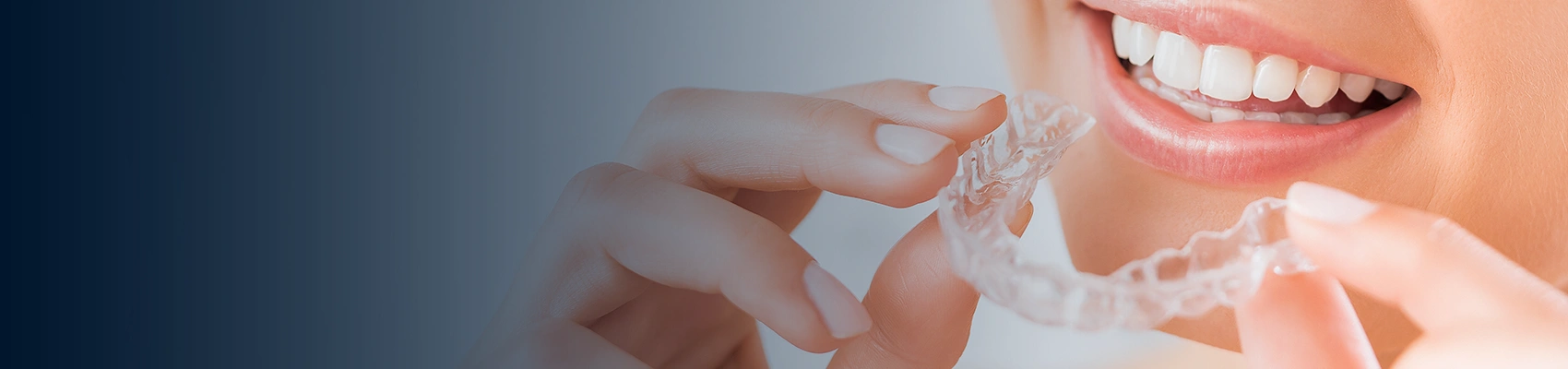 How Can I Spread The Cost For Invisalign In London?