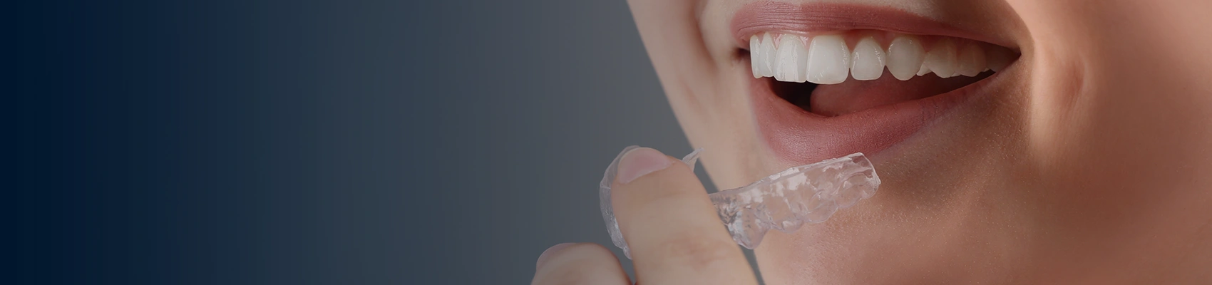 How Does Acceledent Optima Work?