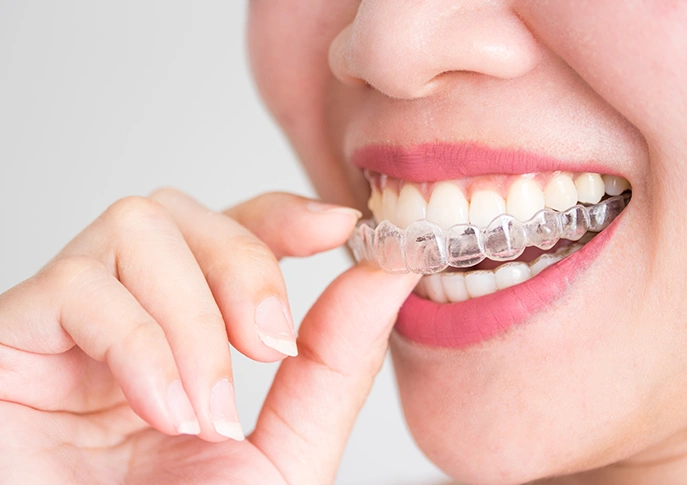 How Effective Are Invisalign Clear Plastic Braces?