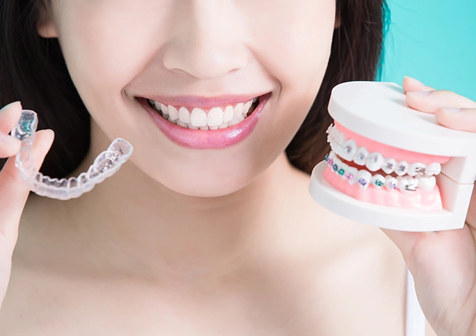 invisalign-i7 provider in London by Bayswater Dental Clinic