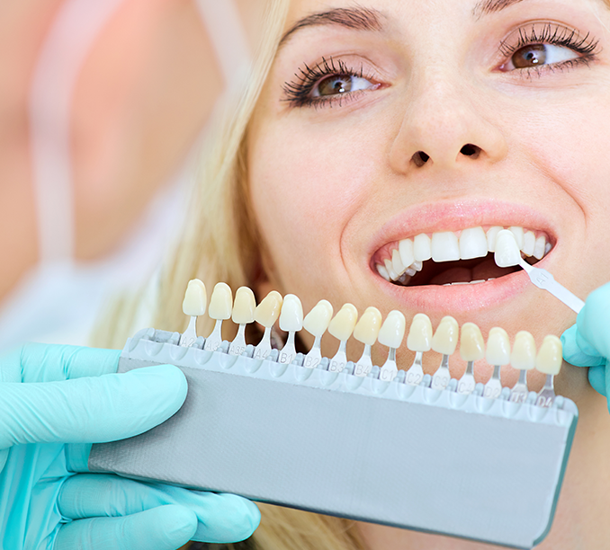 Is Composite Bonding the Same as Porcelain Veneers? 