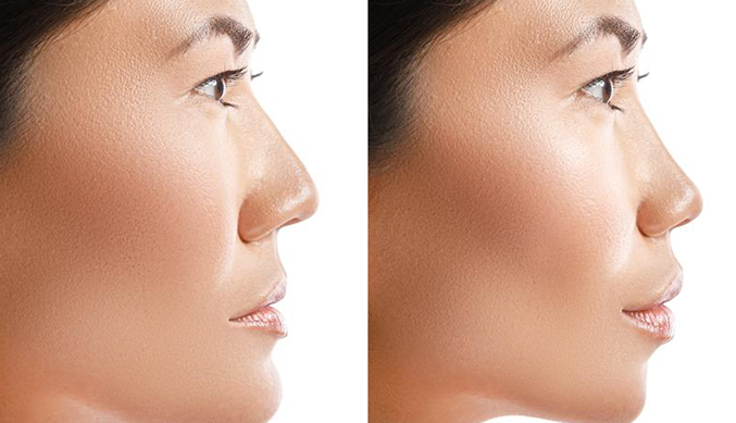 Why Choose This Approach?