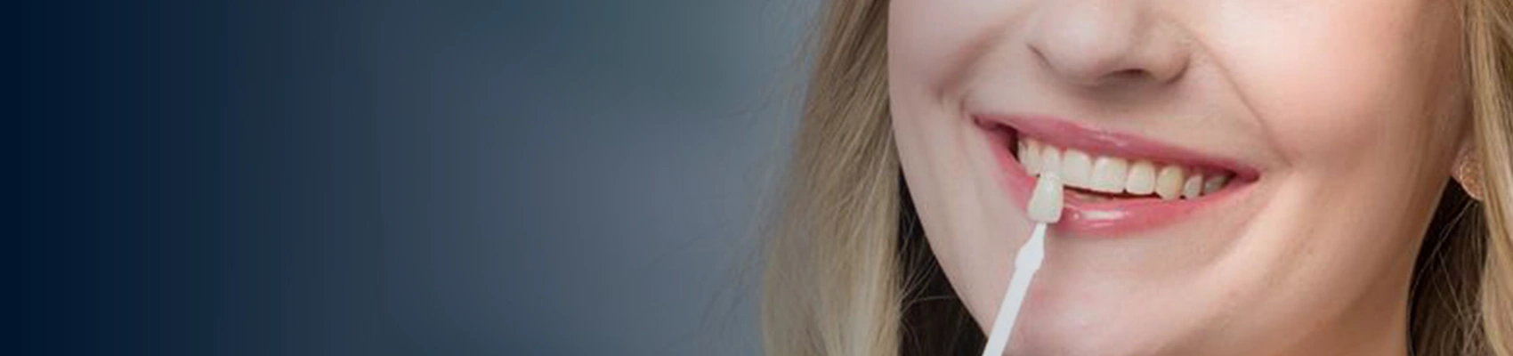 Porcelain Veneers Banner Image 