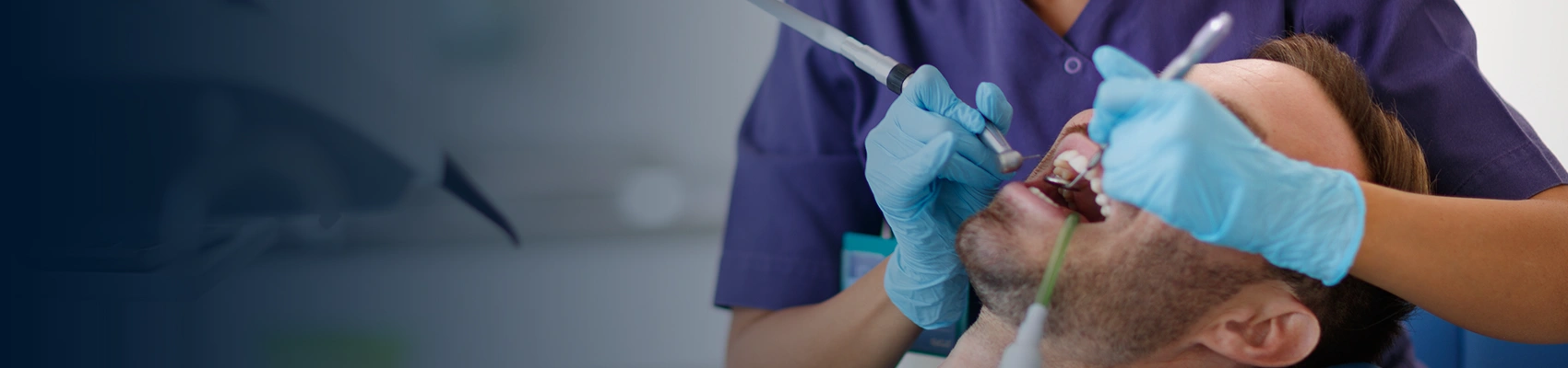 Success Rate Of Root Canal Banner