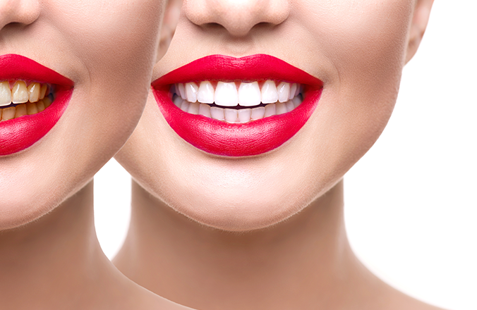 PRP Alternatives Image