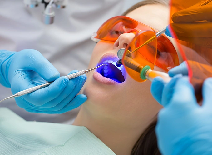 Tooth White Fillings in London by Bayswater Dental Clinic