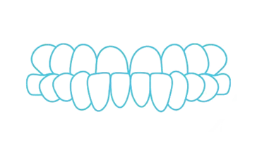 Underbite icon - Bayswater Dental Clinic