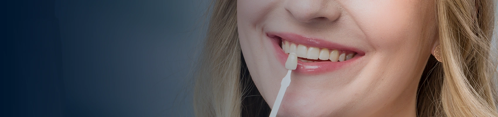 What Are The Advantages of Composite Venners Banners image