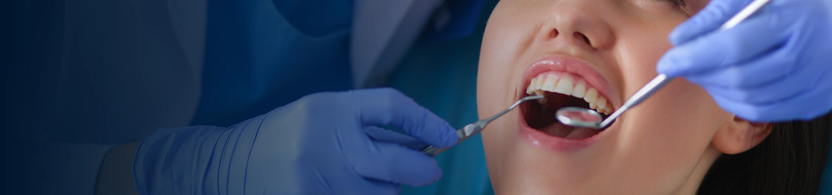 What Does Invisalign Treatment Cost Include?