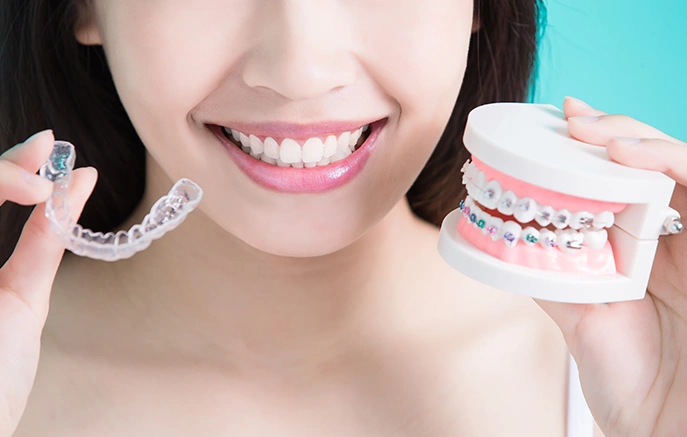 What's not included in Invisalign special offers - Bayswater Dental