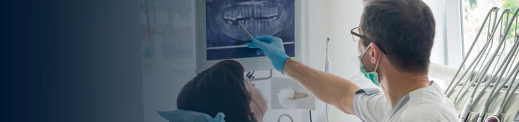 Composite Veneer Banner Image