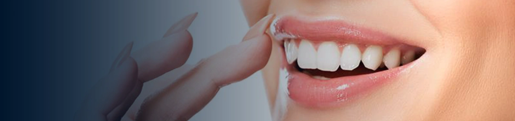 Banner Image of Venners