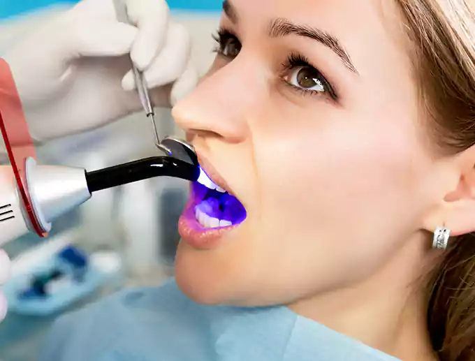 What Should Be Included in the Price?