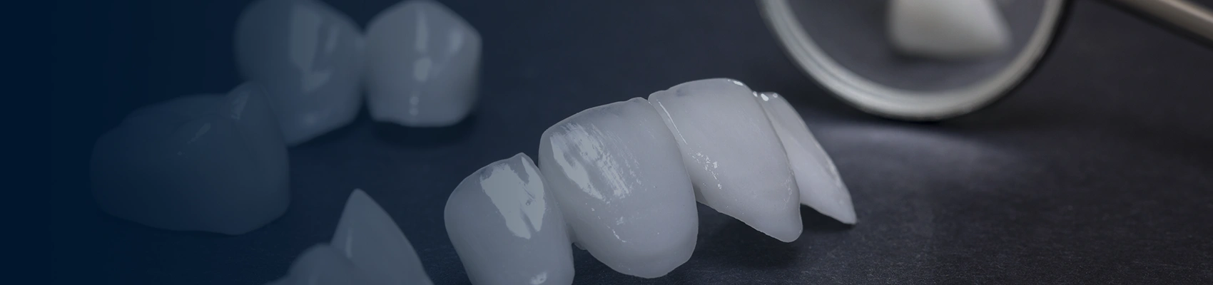Composite Veneers Banner Image