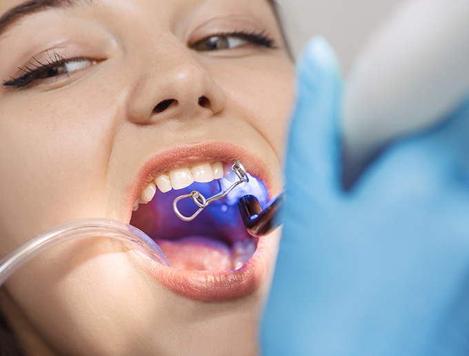 Why Some Quotes Look Too Cheap