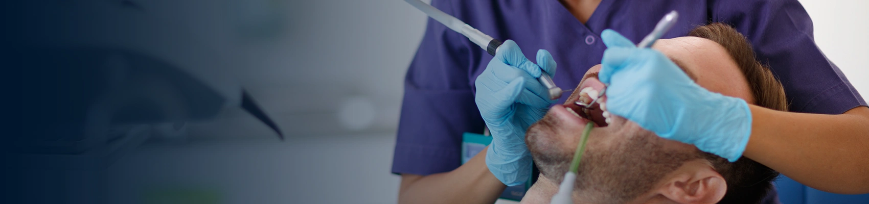 Wisdom Teeth Removal Recommendation Banner