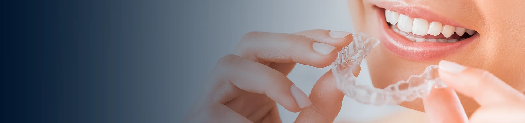 Wisdom tooth extraction and removal banner image – Bayswater Dental Clinic