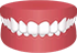 Overbite of the teeth